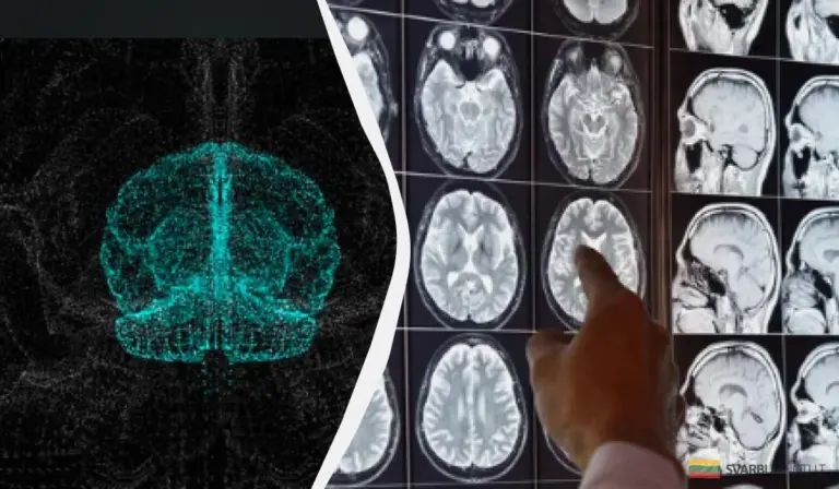 Bakterie z jelit ratunkiem na Alzheimera? Niespodziewane odkrycie naukowców z Karolinska Institute