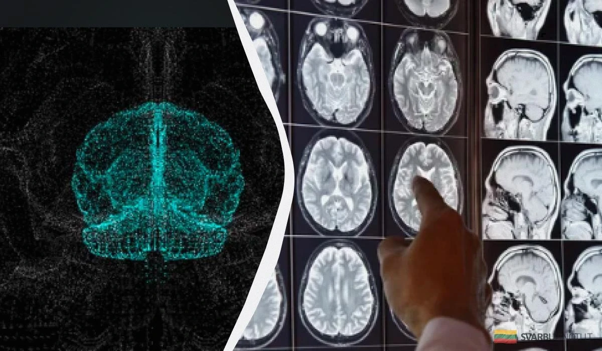 Bakterie z jelit ratunkiem na Alzheimera? Niespodziewane odkrycie naukowców z Karolinska Institute