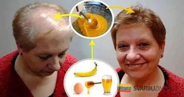 Domowy przepis, który przyspiesza wzrost włosów. Efekt zaskoczy nawet lekarzy.