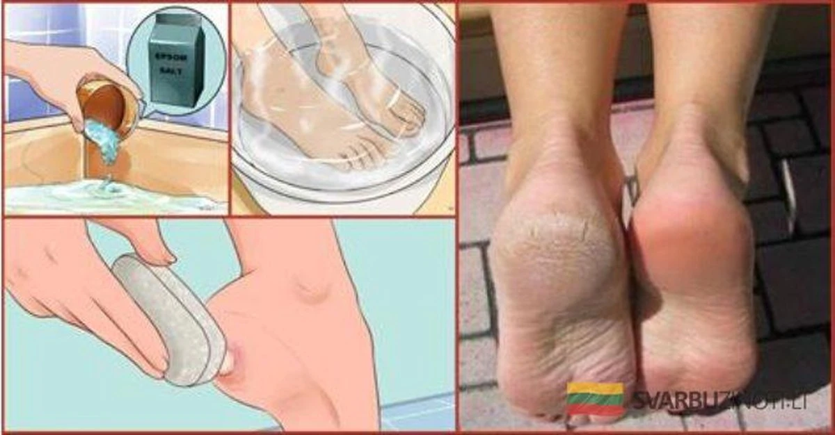 Domowy pedicure za grosze, który zmiękcza skórę nóg jak po wizycie u kosmetyczki