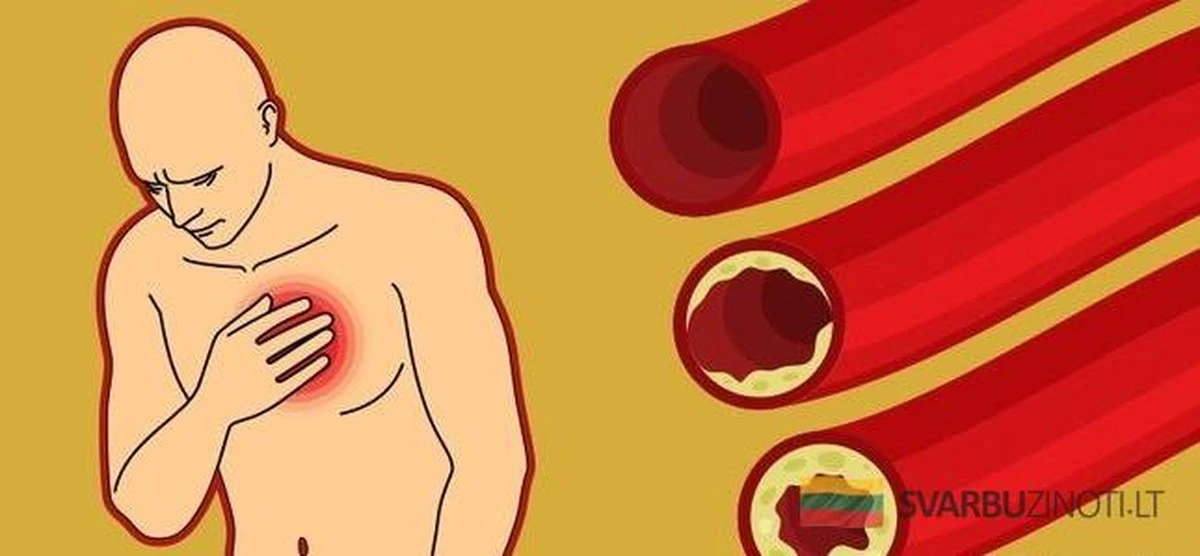 9 produktów spożywczych, które naturalnie oczyszczają Twoje tętnice